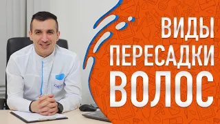 Виды пересадки волос