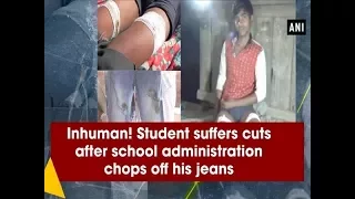 Inhuman! Student suffers cuts after school administration chops off his jeans - Uttar Pradesh News