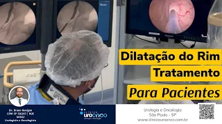 Rim dilatado (hidronefrose). Urologista demonstra o tratamento por endoscopia e cateter duplo j.