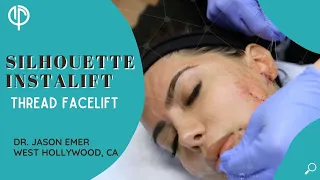 Silhouette InstaLift: New Thread Facelift Procedure!