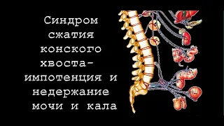 Синдром сжатия конского хвоста-  импотенция и недержание мочи и кала