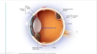 Ocular tumor