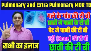 छाती के टी बी,गले की टी बी,बोन टी बी,Pulmonary tb and Extra Pulmonary Tb treatment #mdrtbtreatment