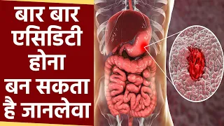 Acidity बार बार होने के कारण हो सकती है गंभीर बीमारी, Peptic Ulcer Disease के जानें कारण और लक्षण