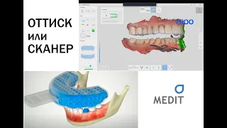 Что лучше? Аналоговый оттиск против цифрового оттиска!