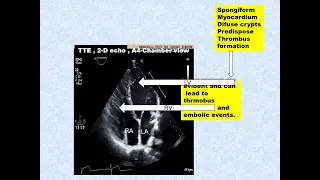 1 Test your skill Atlas Echo myocardial diseaseCM   Part 1