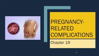 Ricci Ch 19 Pregnancy Related Complications S20