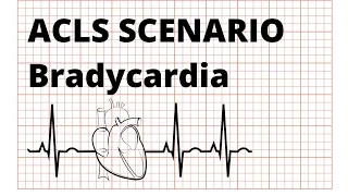 Management of Bradycardia || ACLS scenario
