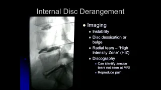 Imaging of Basics of spine injury