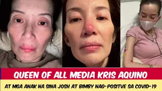 NAKAKALUNGKOT!KRIS AQUINO AT MGA ANAK NA SINA JOSH AT BIMBY NAGPOSITIBO SA VIRUS KRIS LALONG PUMAYAT