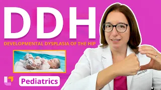 Developmental Dysplasia of the Hip (DDH): Alterations of Health - Pediatric Nursing | @LevelUpRN