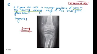 NEET-PG 2021 Recall Questions || Question No 1 to 10 || Dr. Shankar Dey