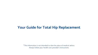 Your Guide for Total Hip Replacement