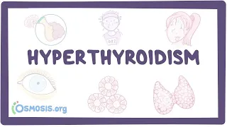 Hyperthyroidism - an Osmosis Preview