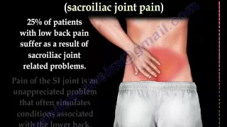 Sacroiliac Joint pain and dysfunction - Everything You Need To Know - Dr. Nabil Ebraheim, M.D.