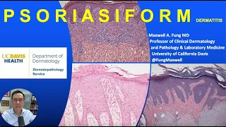 DERMATOPATHOLOGY: Psoriasiform Dermatitis