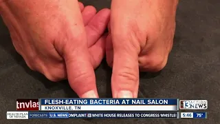 Tennessee woman contracts flesh-eating bacteria at nail salon