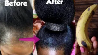 How to grow long and thicken hair fast with Banana and Egg