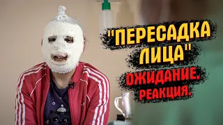 До слез  Долгожданная операция на лицо для  Ани  Увидев себя Аня заплакала