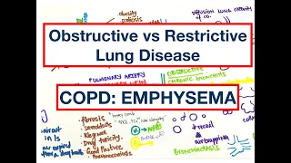 Obstructive vs Restrictive Lung Disease | COPD: Emphysema | DLCO, FEV1/FVC, Compliance | MCQ | USMLE