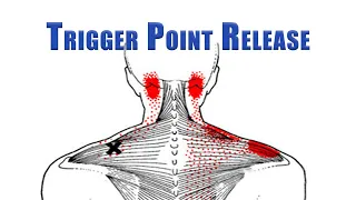 Trigger Point Release | Upper Trapezius, Levator Scapulae and Suboccipitals | No Tools Needed