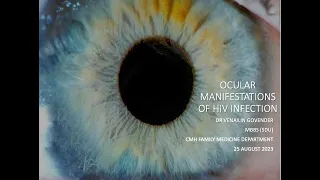 Ocular Manifestations of HIV