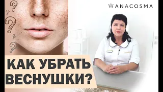 Как убрать веснушки☀️ Удалить веснушки - это навсегда?☀️