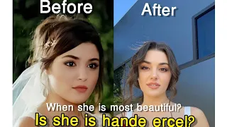 turkish actress Hande erçel plastic surgery|hayat|before and after plastic surgery|is she handeerçel