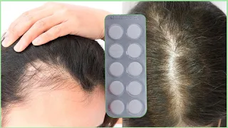 CRECE MUCHÍSIMO 😱 AGREGUE ESTO A MI CABELLO Y AHORA NO PARA DE CRECER