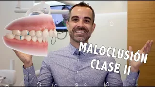 Tooth Boss | Maloclusión clase II || Ortodoncia en Murcia