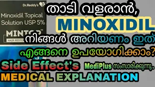 Minoxidil 5% details malayalam | നിങ്ങൾ Minoxidil യൂസ് ചെയ്യുന്നോ? നിങ്ങൾ അറിയണം ഇത്🔥💥