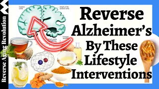 Lifestyle Interventions to REVERSE Cognitive Decline & Alzheimer’s - Fix The Root Causes!!!