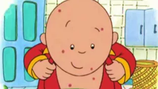 Caillou | Caillou has Chicken Pox | Full Episodes | Funny Animated Videos For Kids | Kids TV Shows