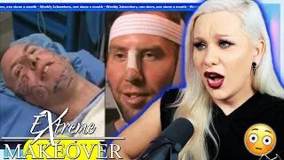 Is this Facial Masculinisation Surgery? (Extreme Makeover) Luxeria