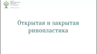 Открытая и закрытая ринопластика - что лучше?