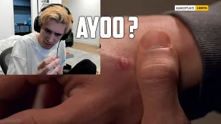 xQc was Bitten at the Same Spot as Spiderman / Insane Coincidence