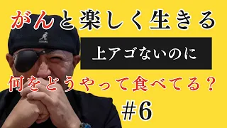 06 末期がん（上顎洞）サバイバー 上アゴないのに何食べてる？