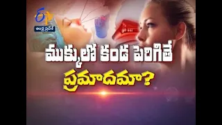 About Nasal Polyps | Sukhibhava | 18th August 2021 | ETV Andhra Pradesh