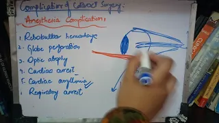 COMPLICATIONS OF CATARACT SURGERY part 1 made simple now!