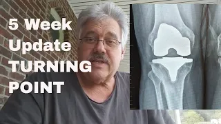 5 week update (FINALLY HIT THE TURNING POINT)  after my total knee replacement surgery