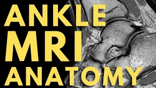Ankle MRI Anatomy | Radiology anatomy part 1 prep | How to interpret an ankle MRI