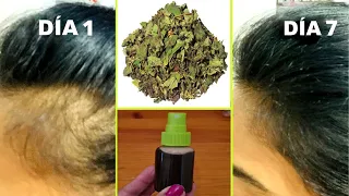 Recupera cabello de LAS SIENES y zonas despobladas con esta receta💪🟢Cabello fortalecido y sin caída