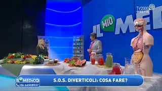 Diverticoli: cosa fare? Cosa mangiare? Tutte le cure