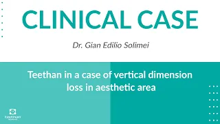 CLINICAL CASE | Teethan in a case of vertical dimension loss in aesthetic area