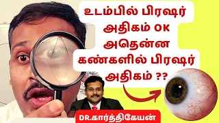 கண்களில் பிரஷர் அதிகமா? ஏன்? குளுகோமா என்ன மருத்துவம்? || doctor karthikeyan tamil