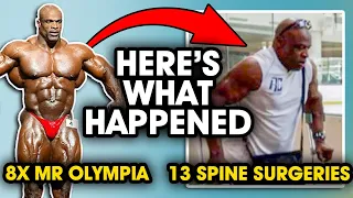 Ronnie Coleman: Mr. 8x Olympia to 13 Spine Sugeries. Here's what happened...