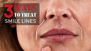 3 ways to treat Smile Lines I nasolabial folds I easy and effective techniques