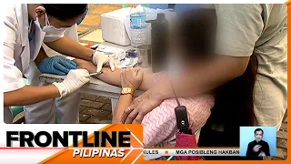 Mga nagpapaturok kontra rabies sa San Lazaro Hospital, umabot na sa 3,000 kada araw