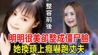 明明是大美女，卻非要整容成「僵屍臉」，這9位女星前後對比太慘烈，她換頭上癮嚇跑丈夫！#高勝美#蕭薔#楊鈞鈞#王祖賢#利菁 #星聞挖挖哇