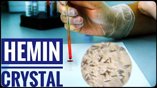 Preparation of Haemin Crystals | Teichmann Test for Blood | Experiment |